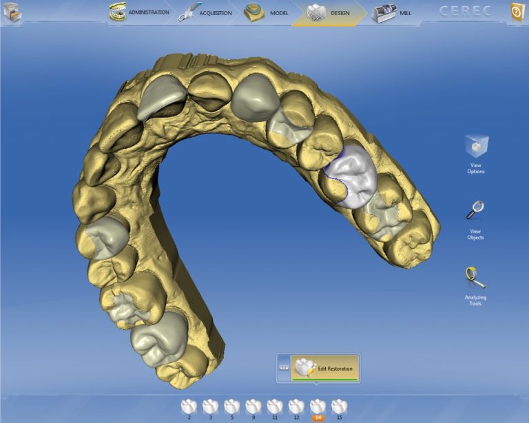 Planejamento digital em 3D de implante dentário e estética dental na clínica da Dra. Camila Freitas em Feira de Santana, Bahia.