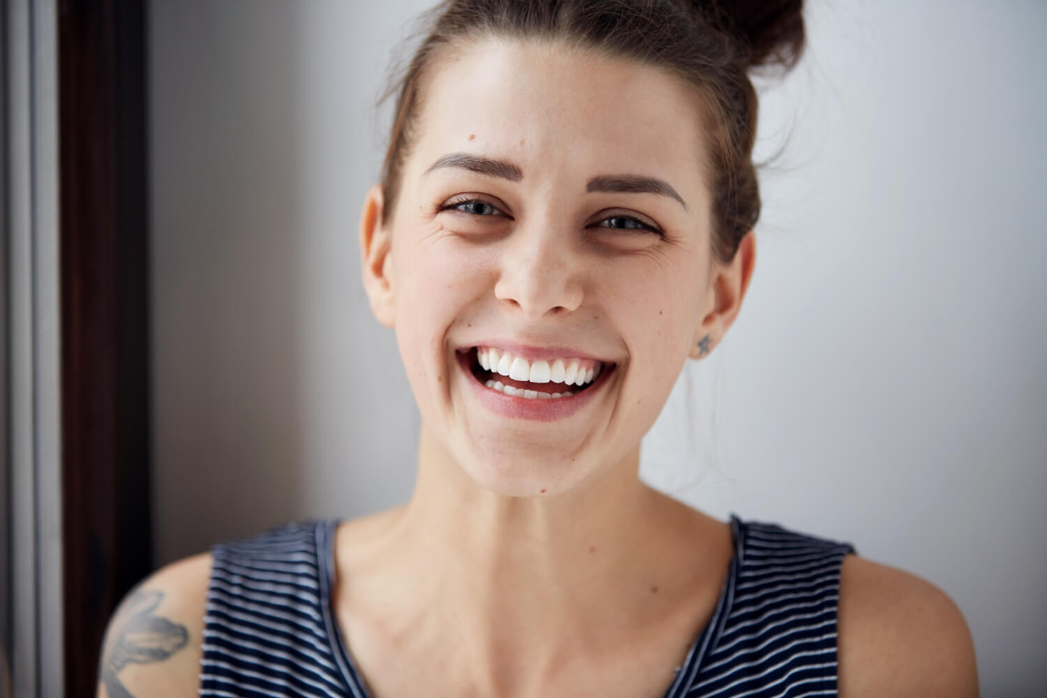 Mulher jovem com sorriso harmônico e dentes brancos, representando o resultado de gengivoplastia em Feira de Santana com Dra. Camila Freitas.